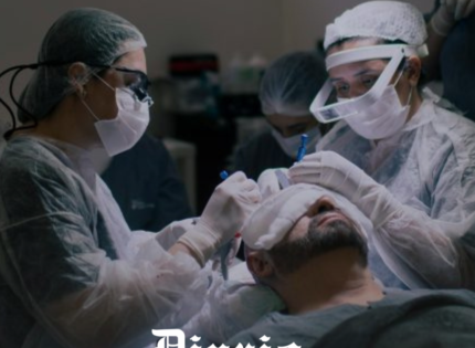 Hombre murió tras someterse a trasplante capilar en Brasil: Sufrió paro cardíaco durante el procedimiento