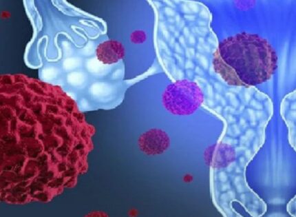 Cáncer cervicouterino: Cuál es la edad sugerida para tomarse exámenes y cómo prevenir el VPH