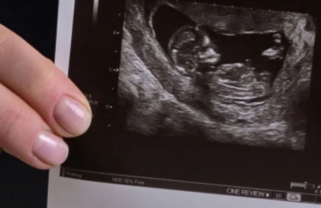 La Iglesia en Chile firme en defensa de la vida ante un proyecto “arbitrario” que busca el aborto sin causales