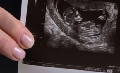 La Iglesia en Chile firme en defensa de la vida ante un proyecto “arbitrario” que busca el aborto sin causales