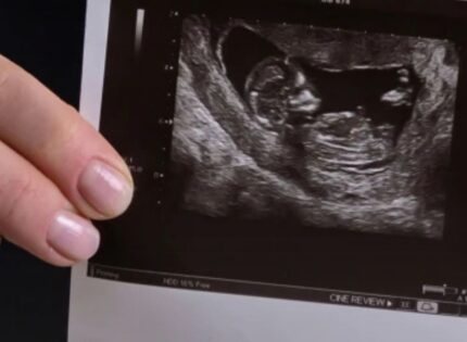 La Iglesia en Chile firme en defensa de la vida ante un proyecto “arbitrario” que busca el aborto sin causales