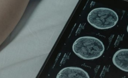 Las tasas de cáncer están aumentando entre personas de 20 a 40 años: ¿Qué dicen los expertos?
