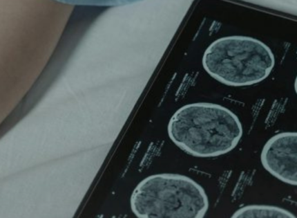 Las tasas de cáncer están aumentando entre personas de 20 a 40 años: ¿Qué dicen los expertos?