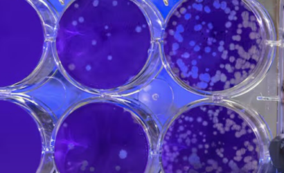 Estas son las células que podrían convertirse en la cura para las enfermedades autoinmunes