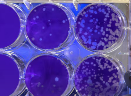 Estas son las células que podrían convertirse en la cura para las enfermedades autoinmunes