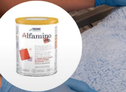 Minsal emite Alerta Alimentaria por toxina que provoca vómitos que estaría en fórmula especial